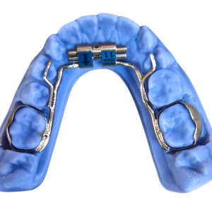 EXPANSION FIJA INFERIOR