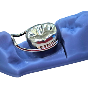 corona ansa vevidental ortorios